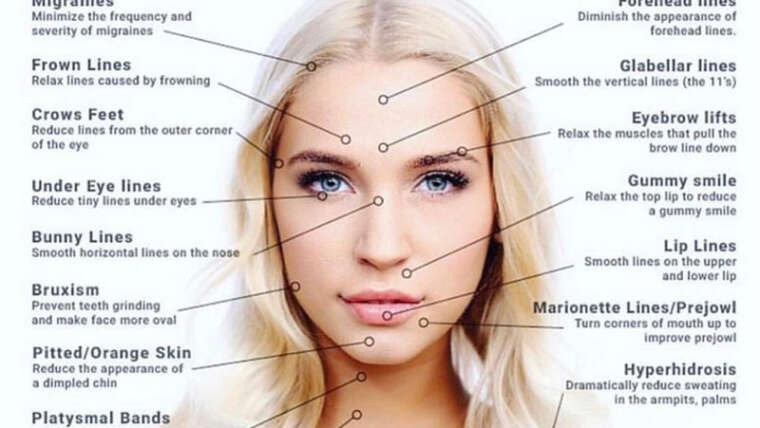 Unlocking the Versatility of Botox: Aesthetic Marvels Beyond Wrinkle Reduction