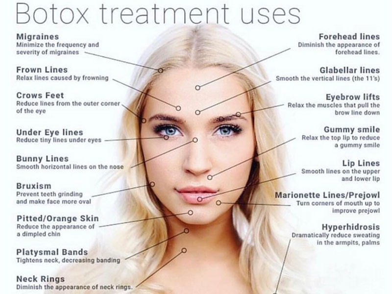 Templum Aesthetics & Wellness Many uses for botox treatment