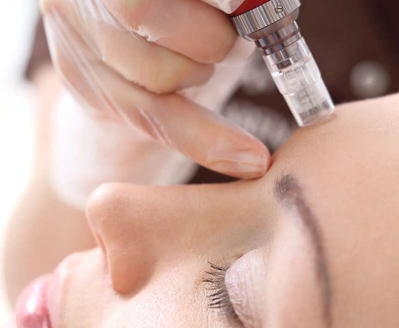 Hyaluronic Acid