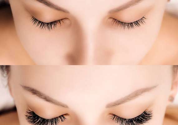 Latisse Eyeless Enhancement - Templum Aesthetics & Wellness
