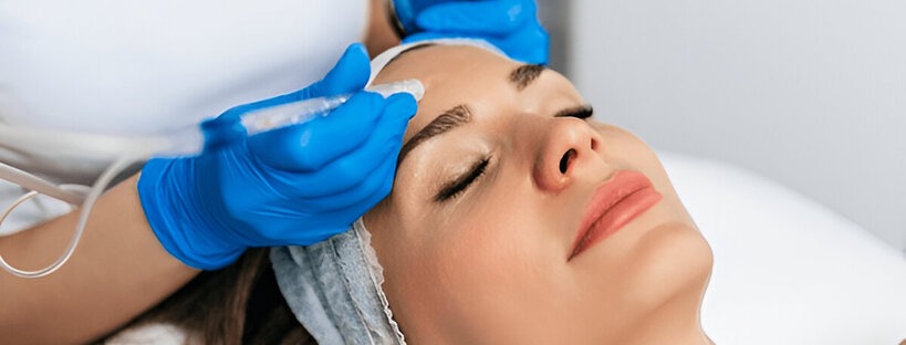 PRP Microneedling Treatment for Acne Scars & Anti-Aging