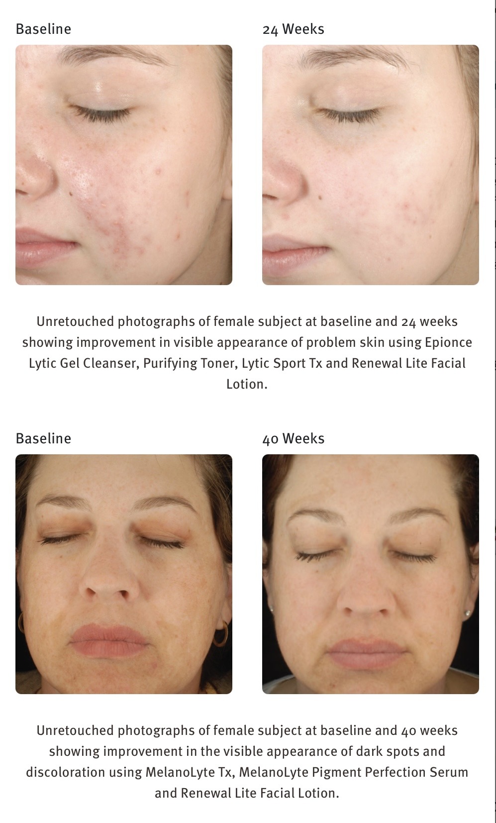EPIONCE RENEWAL LITE FACIAL LOTION ($112) - Image 2
