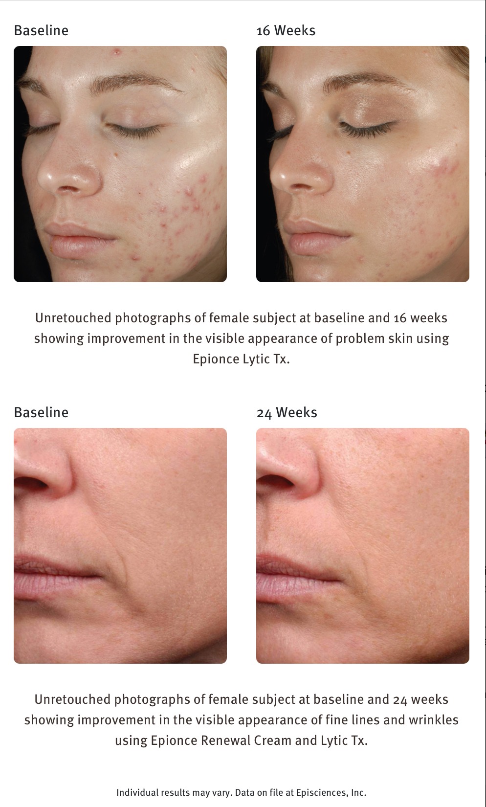 EPIONCE LYTIC TX - Image 2