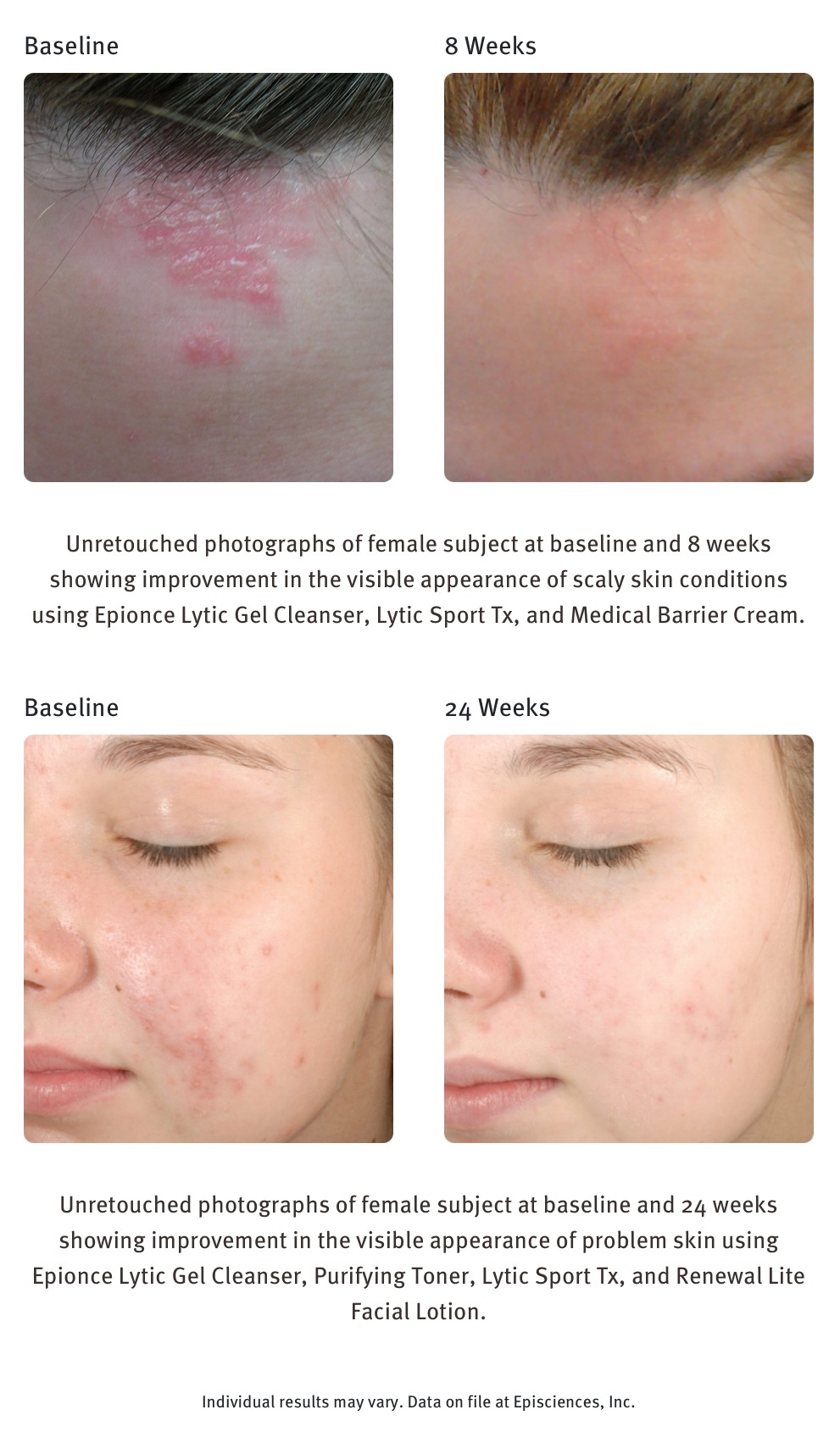 EPIONCE LYTIC SPORT TX - Image 2