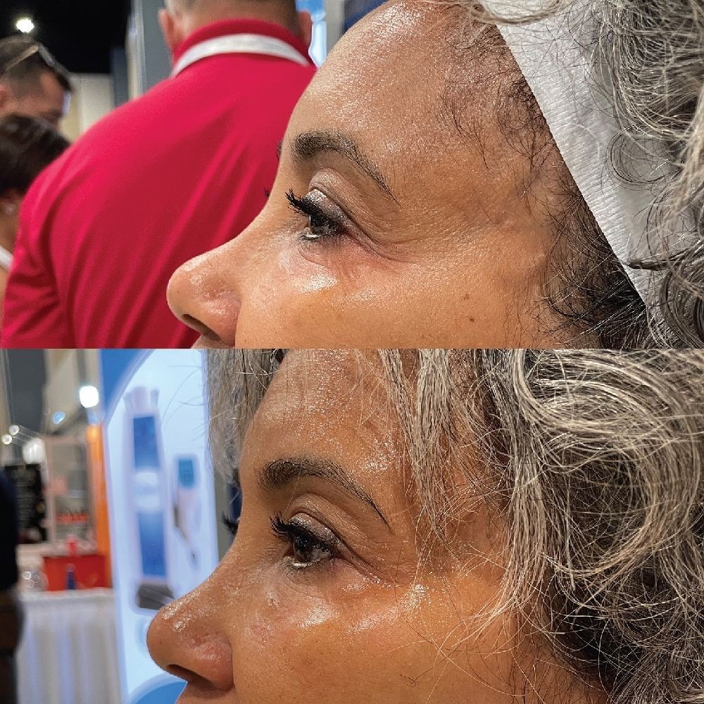 Rejuvenate MD