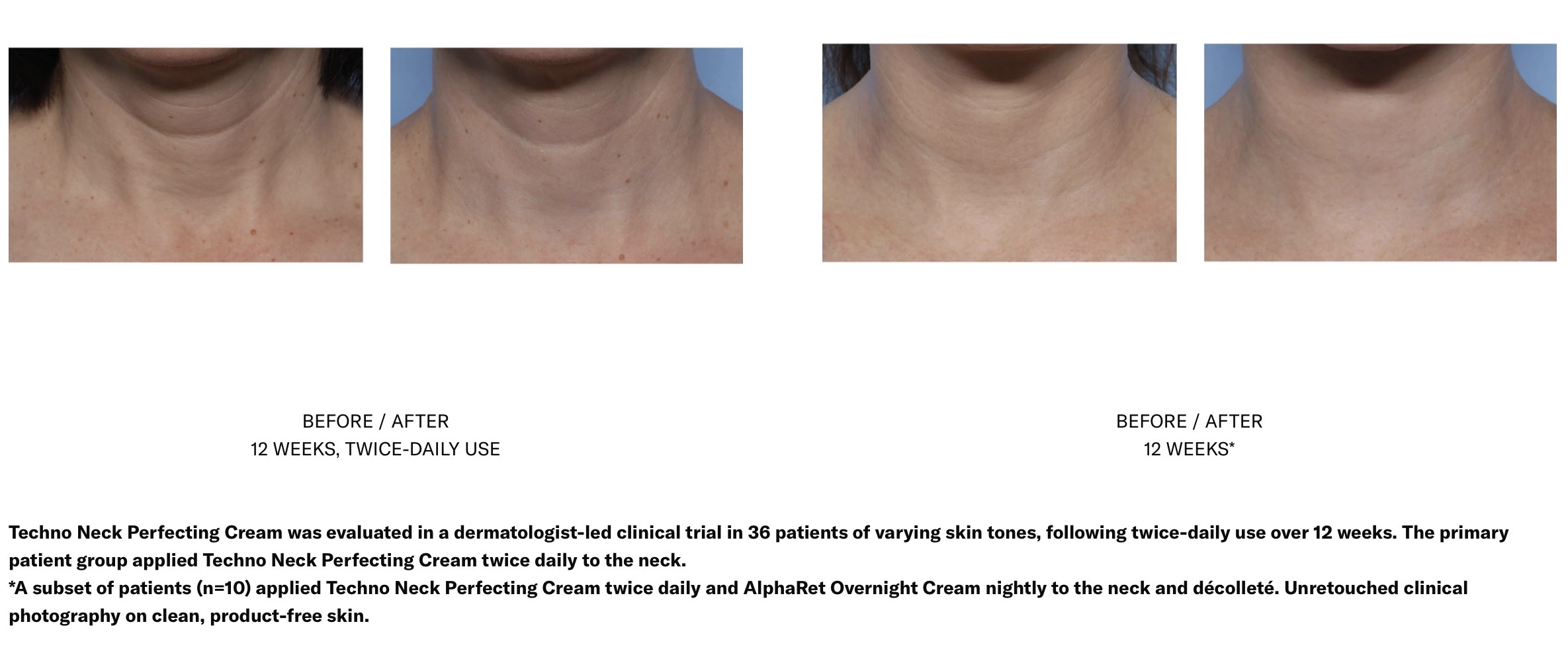 SKIN BETTER SCIENCE TECHNO NECK PERFECTING CREAM - Image 3