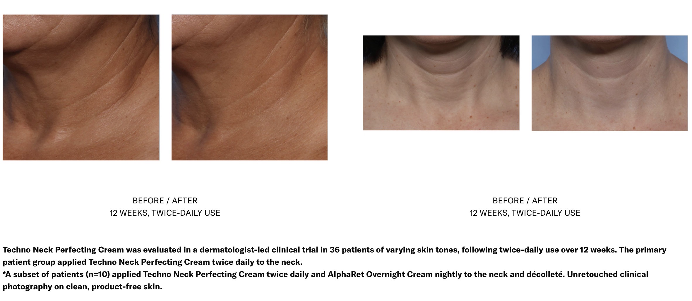 SKIN BETTER SCIENCE TECHNO NECK PERFECTING CREAM - Image 4
