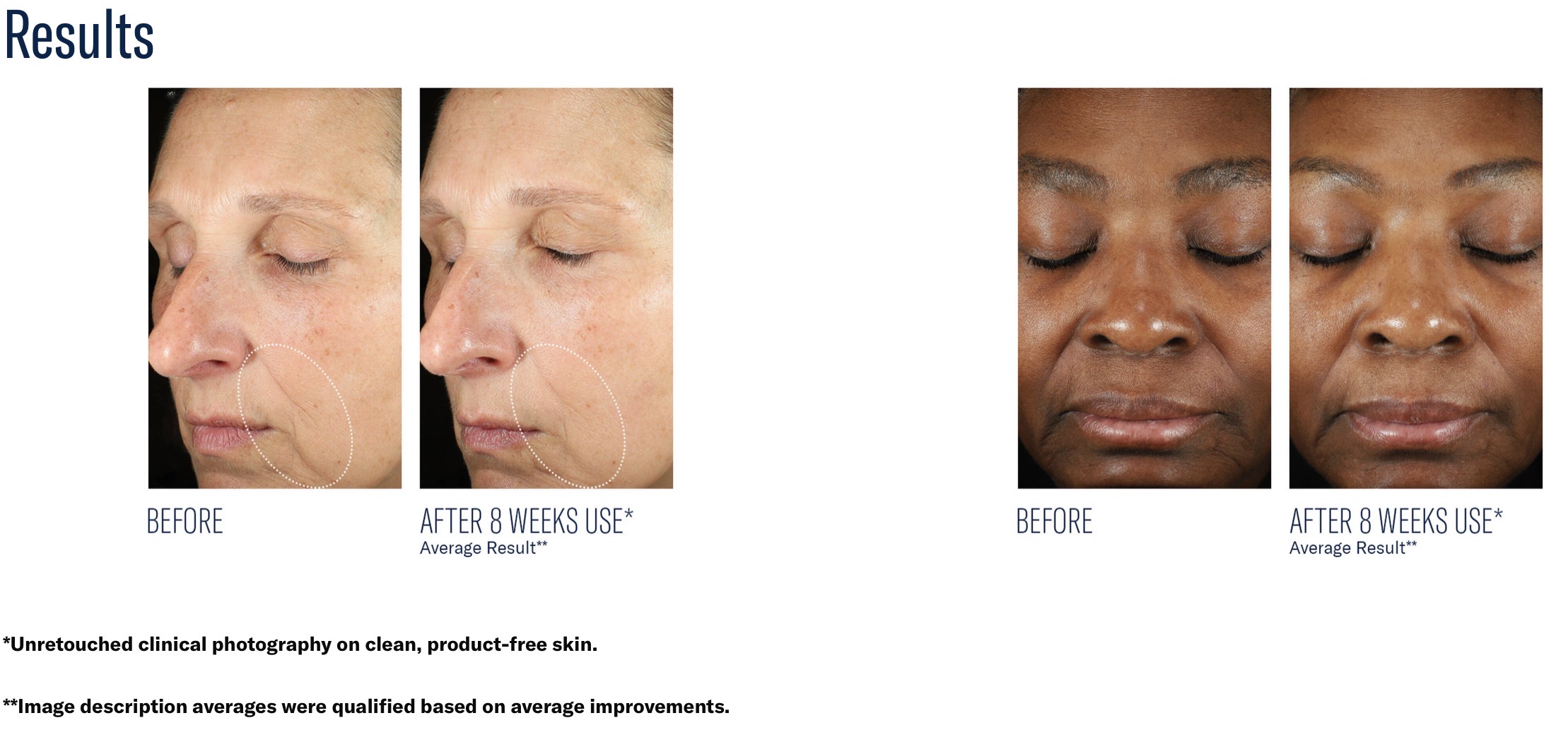 SKIN BETTER SCIENCE MYSTRO REVIVE RENEWING SERUM - Image 7