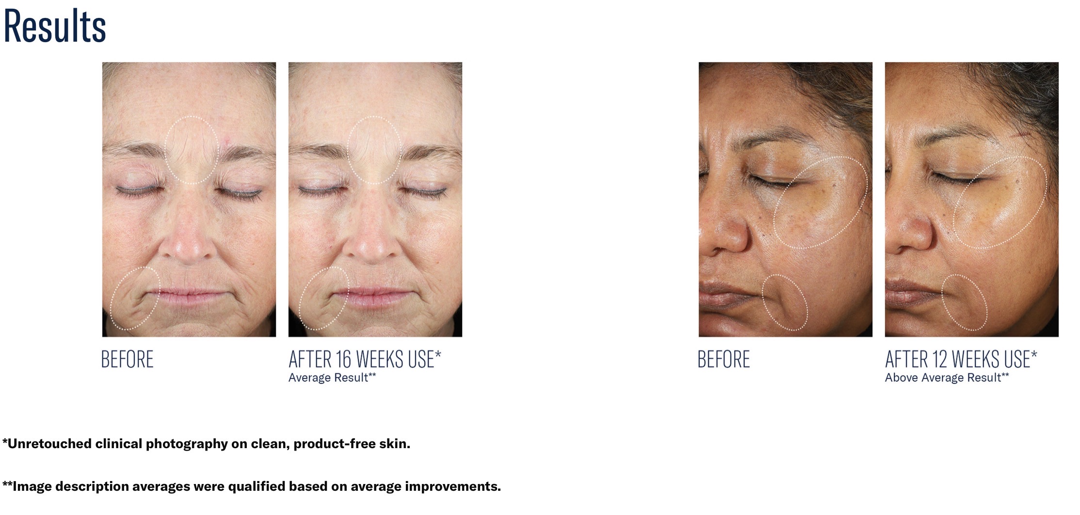 SKIN BETTER SCIENCE MYSTRO REVIVE RENEWING SERUM - Image 6