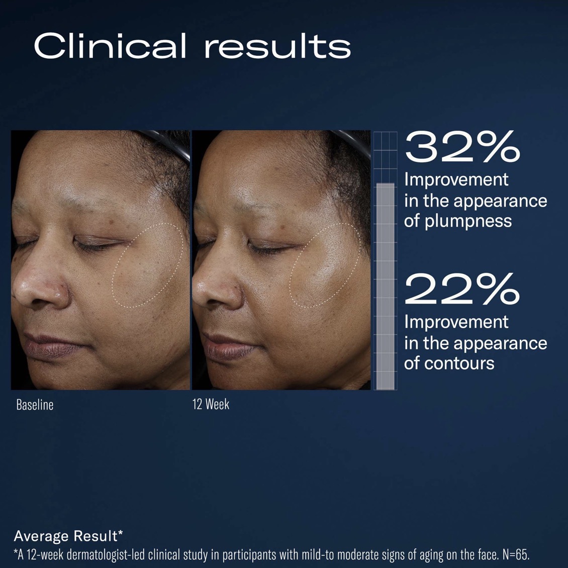 SKIN BETTER SCIENCE AMPRA VOLUMIZING MACRO HA SERUM - Image 6